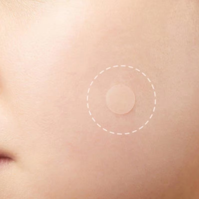 Acne Patch